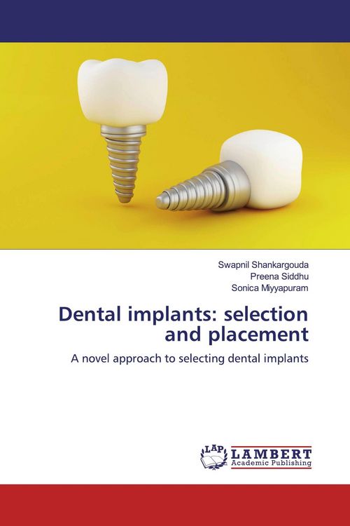 Produktbild: Dental implants: selection and placement
