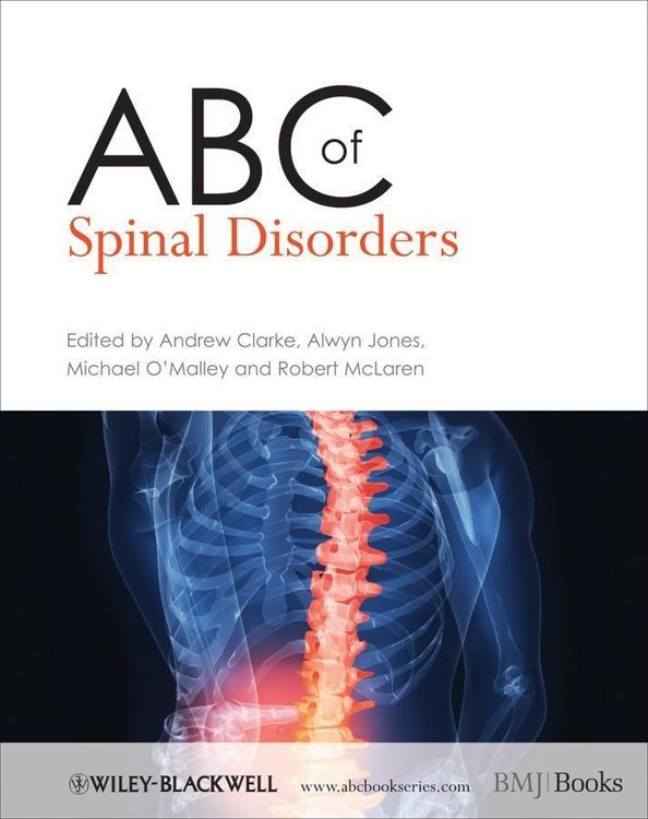 Produktbild: ABC of Spinal Disorders