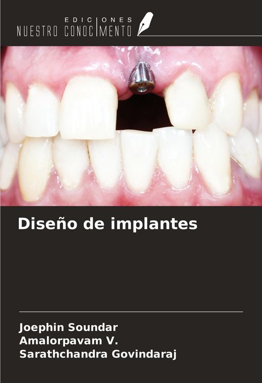 Produktbild: Dise&ntilde;o de implantes