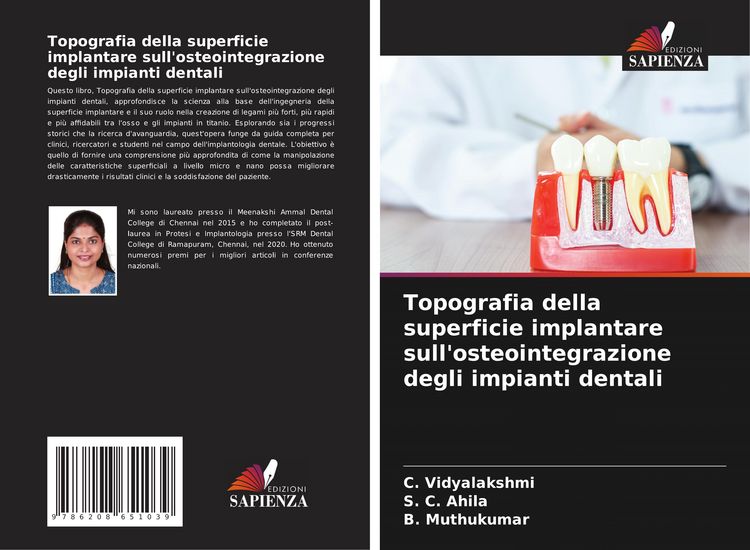 Produktbild: Topografia della superficie implantare sull'osteointegrazione degli impianti dentali