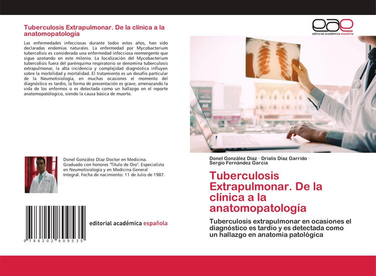Produktbild: Tuberculosis Extrapulmonar. De la cl&iacute;nica a la anatomopatolog&iacute;a