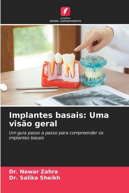 Produktbild: Implantes basais: Uma vis&atilde;o geral