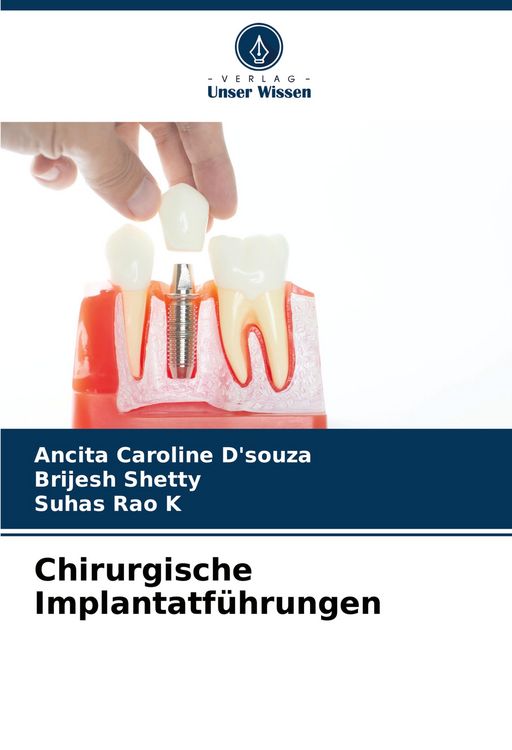 Produktbild: Chirurgische Implantatf&uuml;hrungen