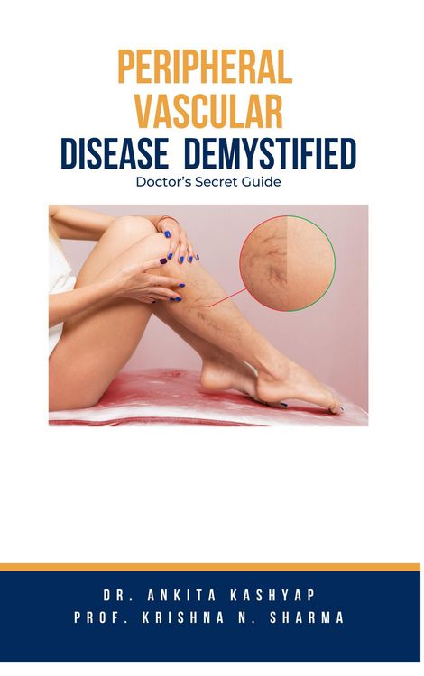 Produktbild: Peripheral Vascular Disease Demystified: Doctor's Secret Guide