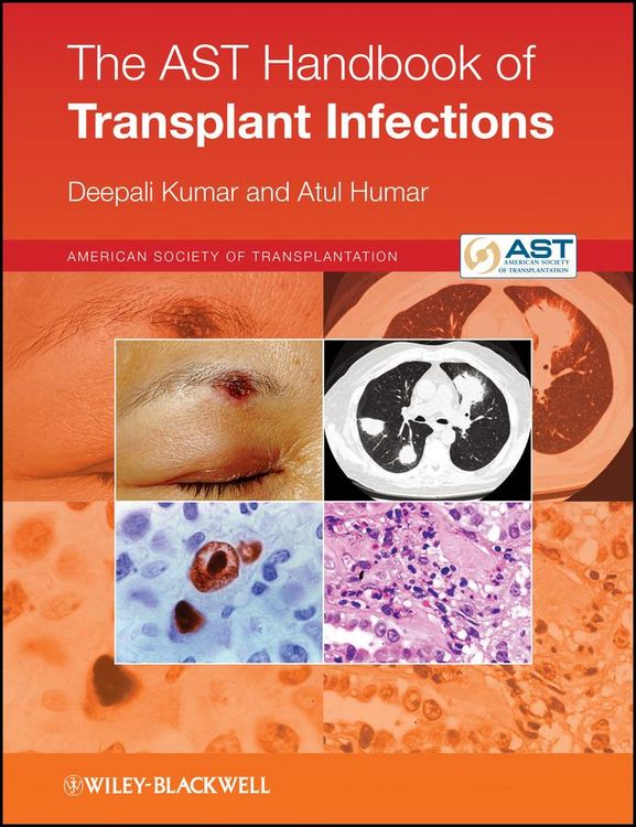 Produktbild: The AST Handbook of Transplant Infections
