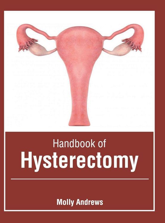 Produktbild: Handbook of Hysterectomy