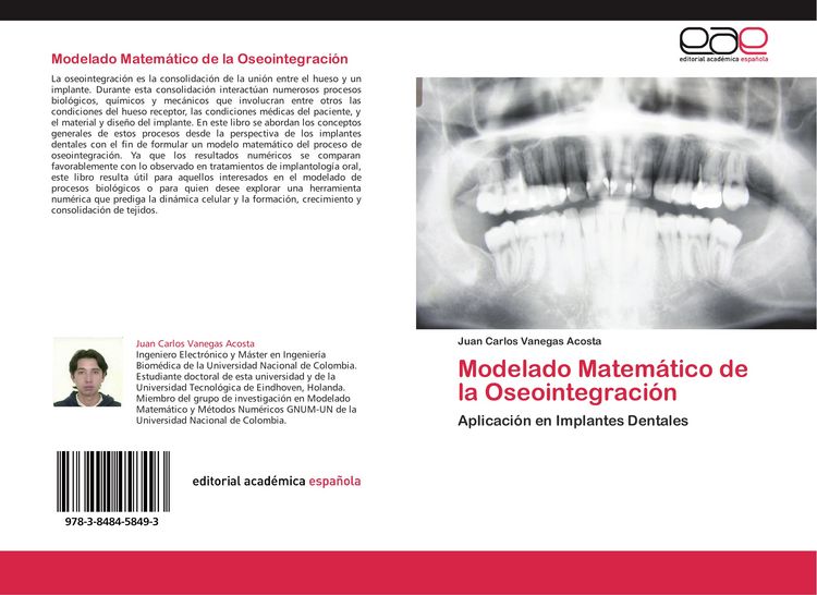 Produktbild: Modelado Matem&aacute;tico de la Oseointegraci&oacute;n