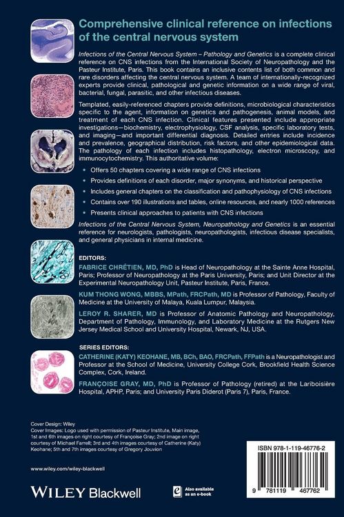 Produktbild: Infections of the Central Nervous System