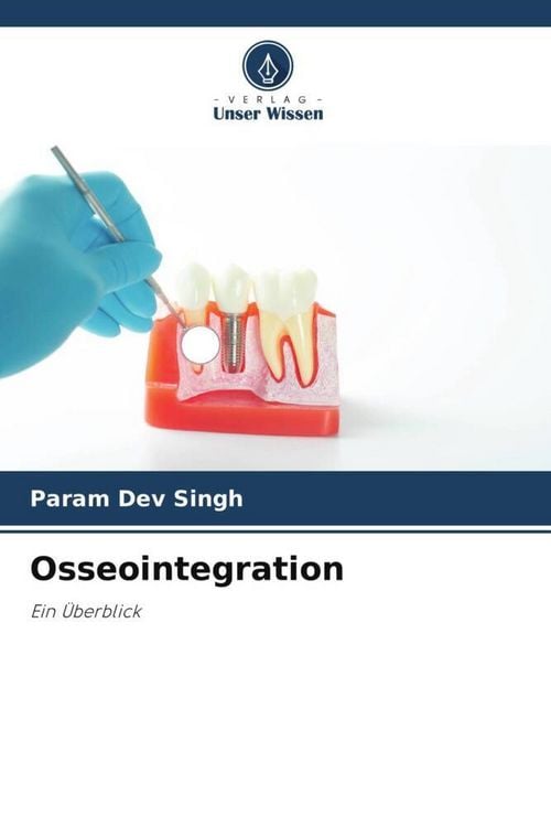 Produktbild: Osseointegration