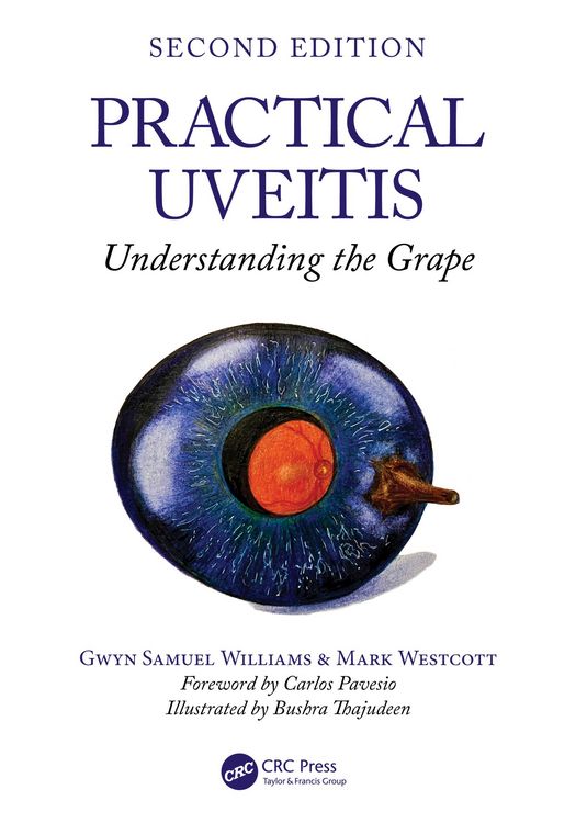 Produktbild: Practical Uveitis