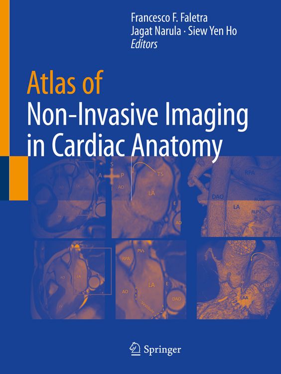 Produktbild: Atlas of Non-Invasive Imaging in Cardiac Anatomy