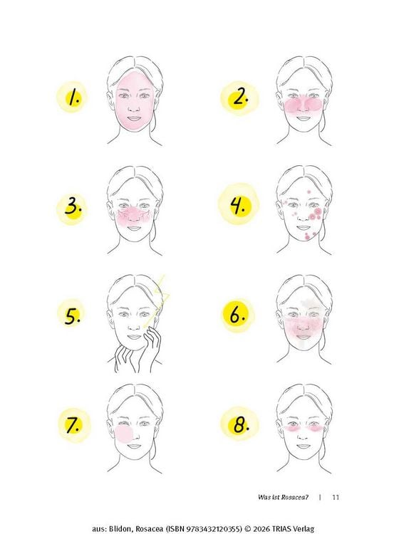 Produktbild: Rosacea