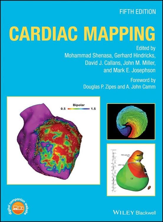 Produktbild: Cardiac Mapping