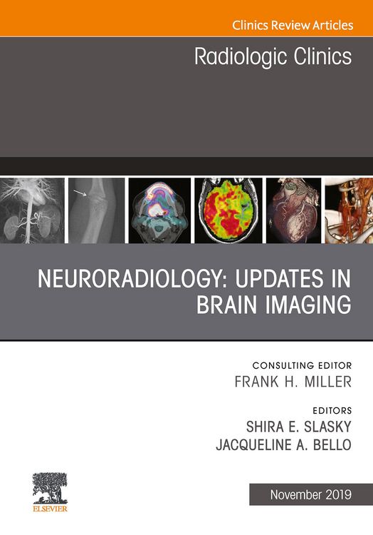 Produktbild: Neuroradiology, An Issue of Radiologic Clinics of North America