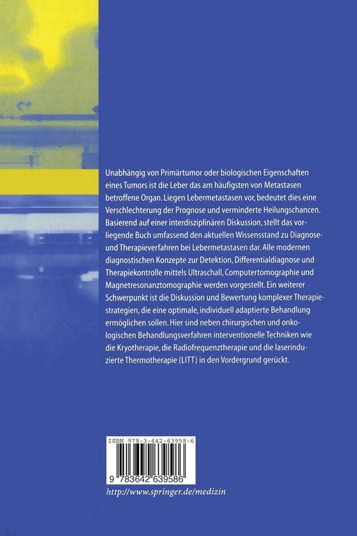 Produktbild: LeberMetastasen