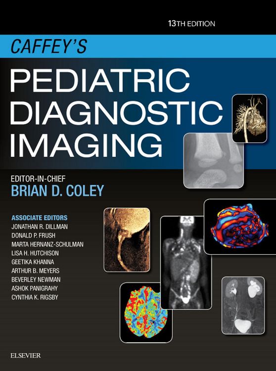 Produktbild: Caffey's Pediatric Diagnostic Imaging E-Book