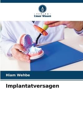 Produktbild: Implantatversagen