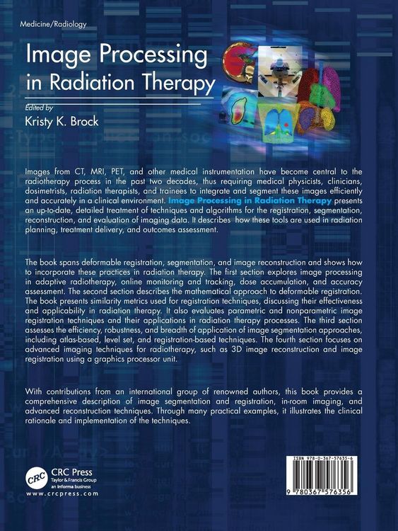 Produktbild: Image Processing in Radiation Therapy