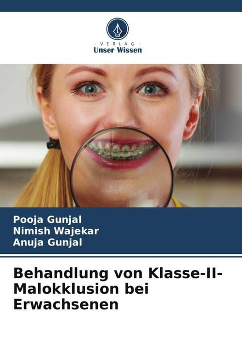 Produktbild: Behandlung von Klasse-II-Malokklusion bei Erwachsenen