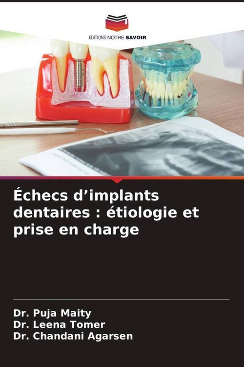 Produktbild: &Eacute;checs d'implants dentaires : &eacute;tiologie et prise en charge