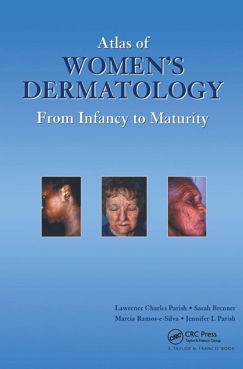 Produktbild: Atlas of Women's Dermatology