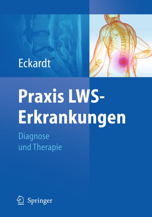 Produktbild: Praxis LWS-Erkrankungen
