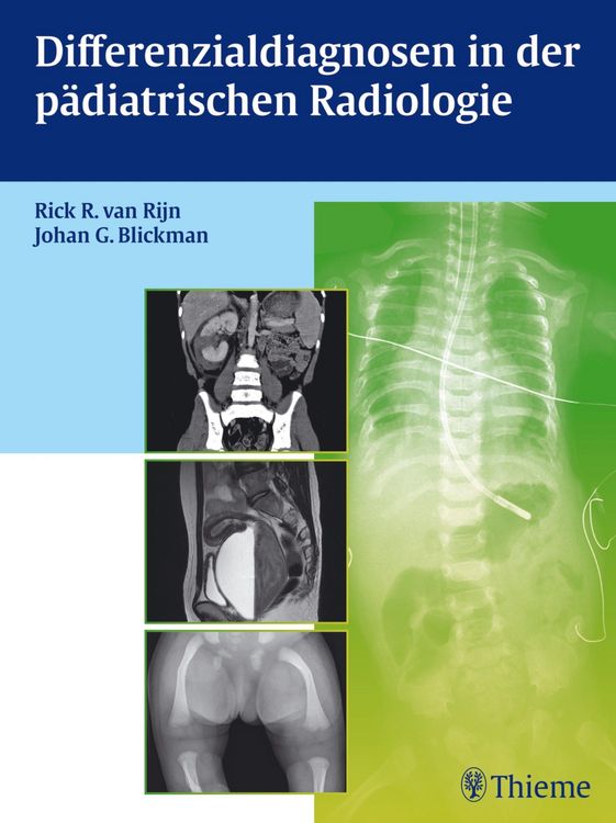 Produktbild: Differenzialdiagnosen in der p&auml;diatrischen Radiologie