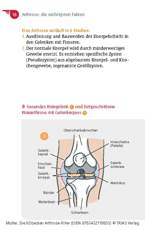 Produktbild: Die 50 besten Arthrose-Killer