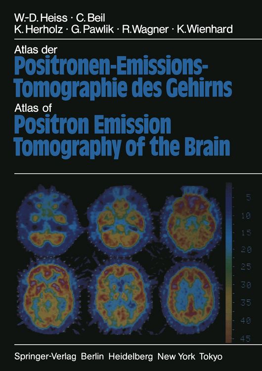 Produktbild: Atlas der Positronen-Emissions-Tomographie des Gehirns / Atlas of Positron Emission Tomography of the Brain
