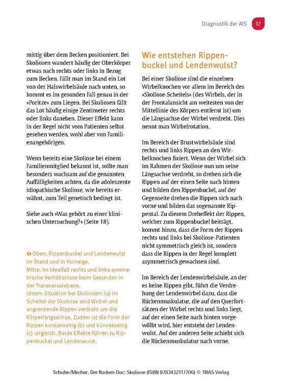 Produktbild: Der R&uuml;cken-Doc: Skoliose