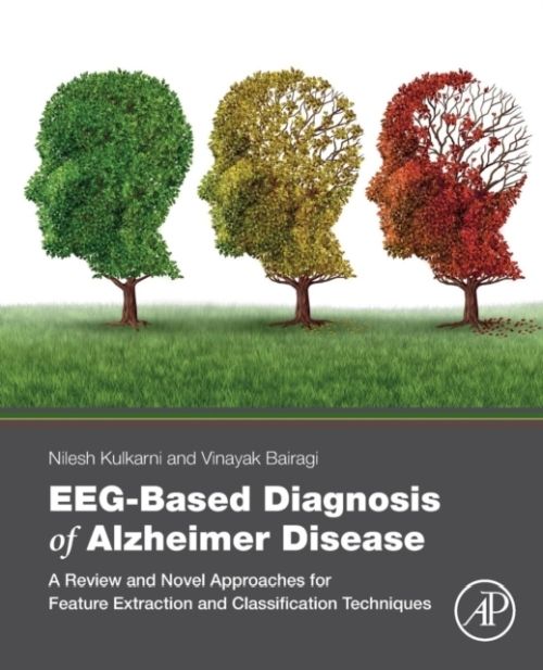Produktbild: EEG-Based Diagnosis of Alzheimer Disease