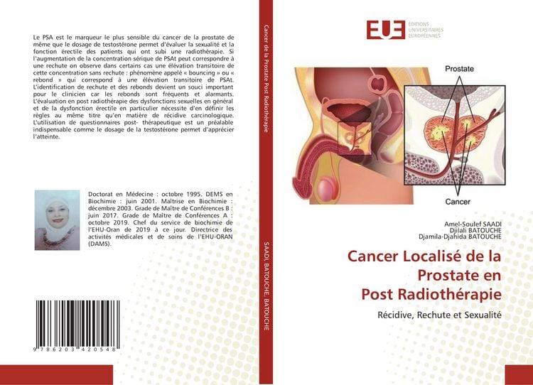 Produktbild: Cancer Localis&eacute; de la Prostate en Post Radioth&eacute;rapie
