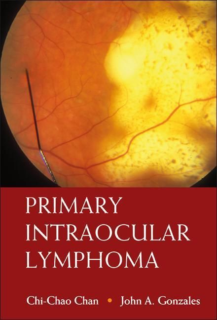 Produktbild: Primary Intraocular Lymphoma
