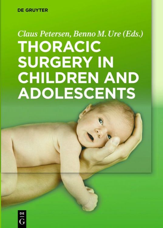 Produktbild: Thoracic Surgery in Children and Adolescents
