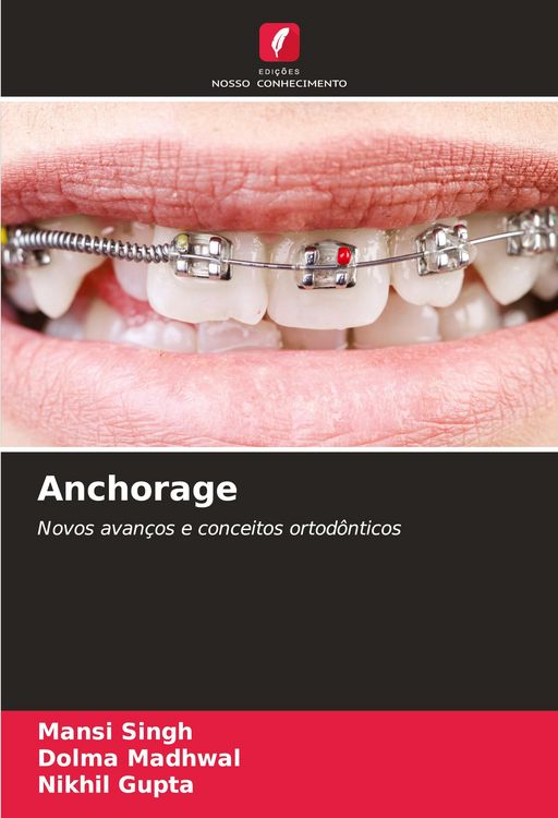 Produktbild: Anchorage