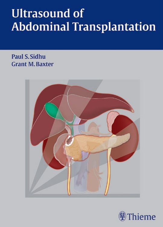Produktbild: Ultrasound of Abdominal Transplantation
