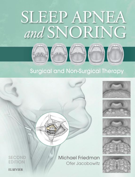 Produktbild: Sleep Apnea and Snoring E-Book