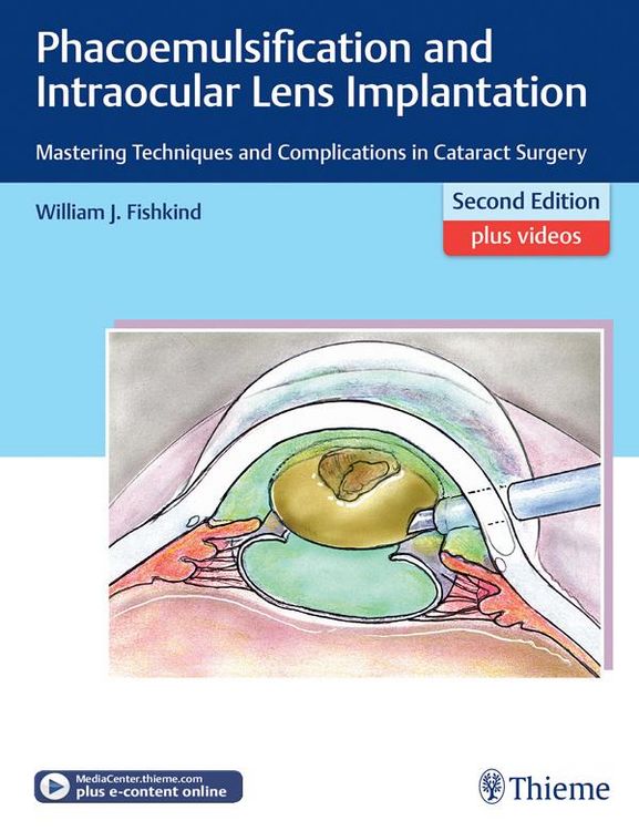 Produktbild: Phacoemulsification and Intraocular Lens Implantation