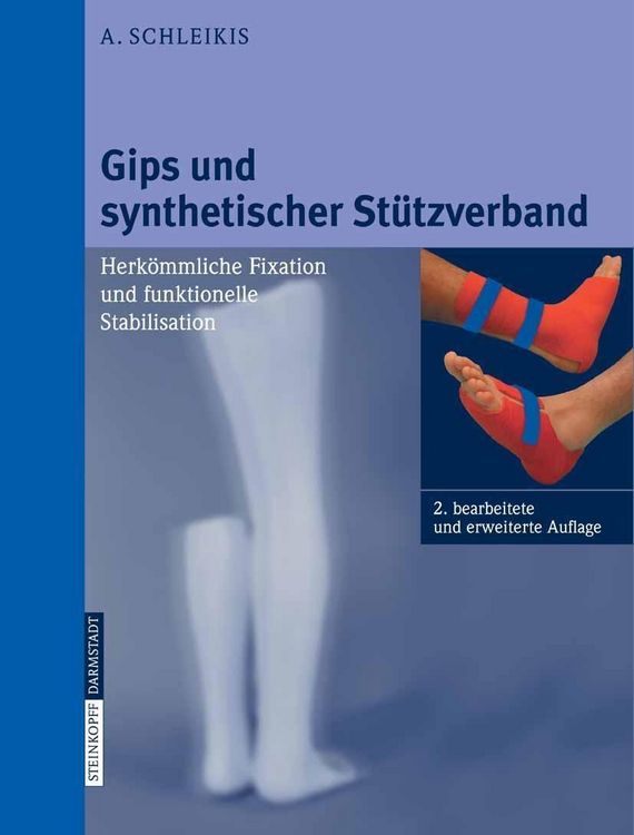 Produktbild: Gips und synthetischer St&uuml;tzverband