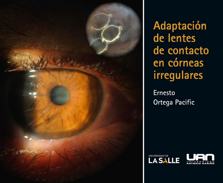 Produktbild: Adaptaci&oacute;n de lentes de contacto en c&oacute;rneas irregulares