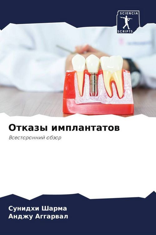 Produktbild: Otkazy implantatow