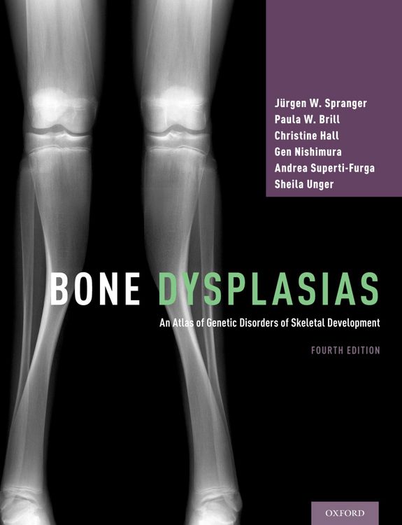 Produktbild: Bone Dysplasias