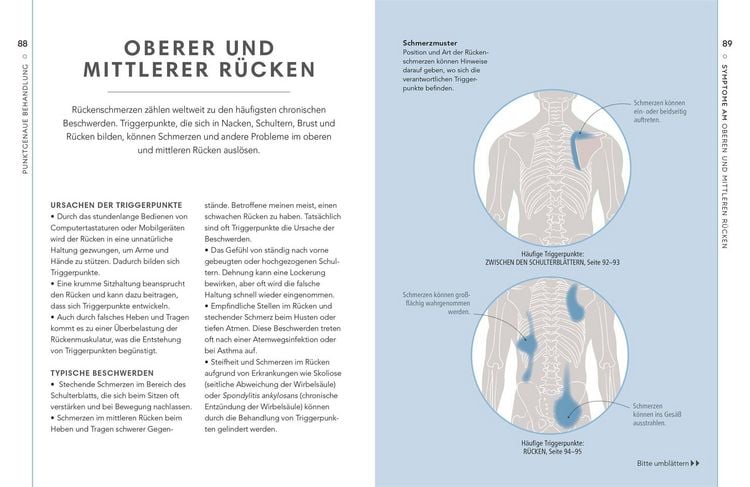 Produktbild: Triggerpunkte