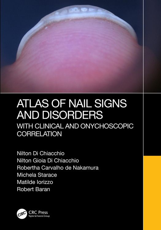 Produktbild: Atlas of Nail Signs and Disorders with Clinical and Onychoscopic Correlation