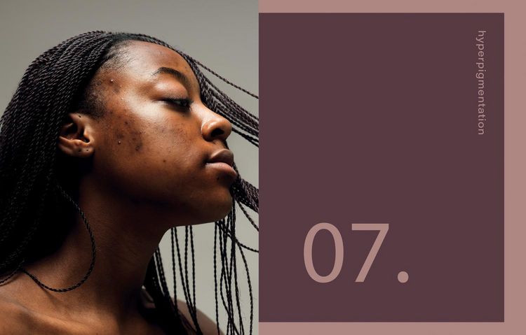 Produktbild: Black Skin