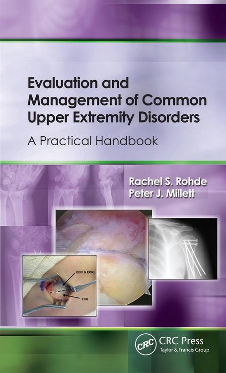 Produktbild: Evaluation and Management of Common Upper Extremity Disorders