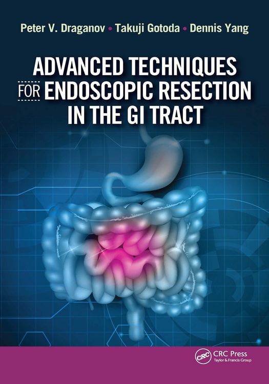 Produktbild: Advanced Techniques for Endoscopic Resection in the GI Tract