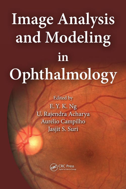 Produktbild: Image Analysis and Modeling in Ophthalmology