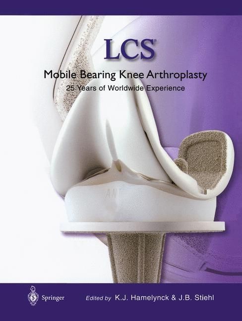 Produktbild: LCS&reg; Mobile Bearing Knee Arthroplasty