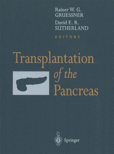 Produktbild: Transplantation of the Pancreas